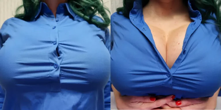 Buttoned Up? Or Ready to Pop? 😉 🔥