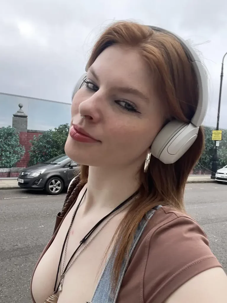 Freckled Beauty: Wanna Play Kiss the Dots? 🤤
