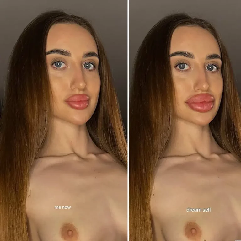 My Dream Lips Are So Hot, And My Boobies Are Next! Is This Too Much, Or Just *Spectacularly* Sexy?