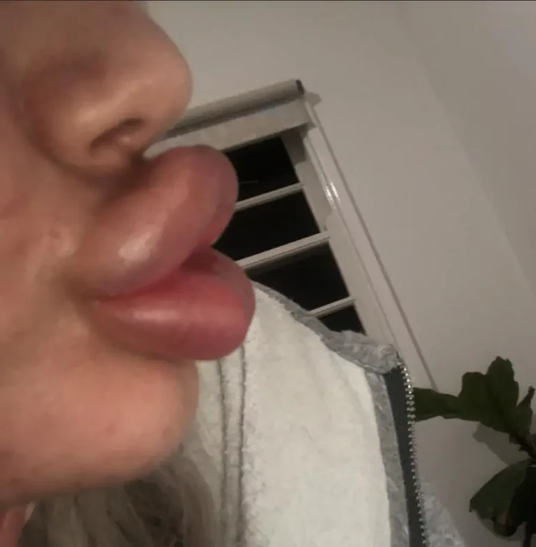 My Enormous, Sexy Pumped Lips: A Desirable Masterpiece You'll Crave