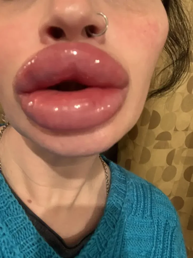 My Hot Big Lips Are Bigger Than Ever, Ready For Your Huge Cock