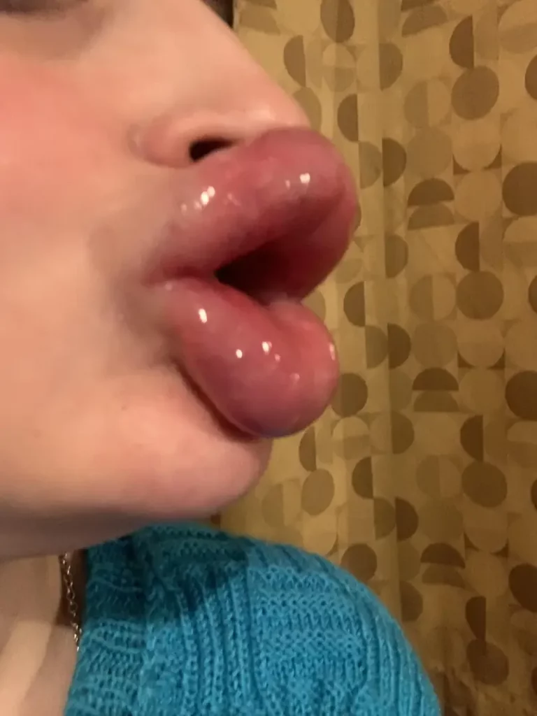 My Hot, Huge Cockholster Mouth: The Ultimate Plastic Bunny Goal