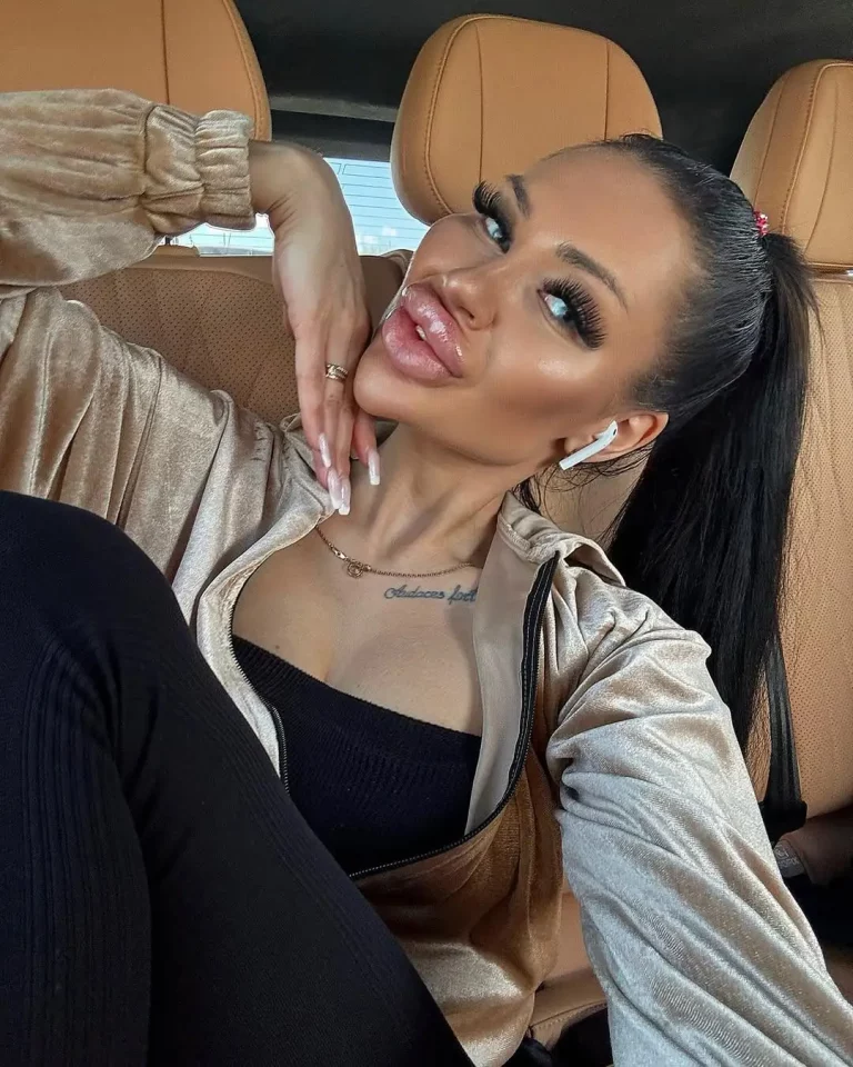 My Juicy Lips Are So Hot, You'll Be Speechless.