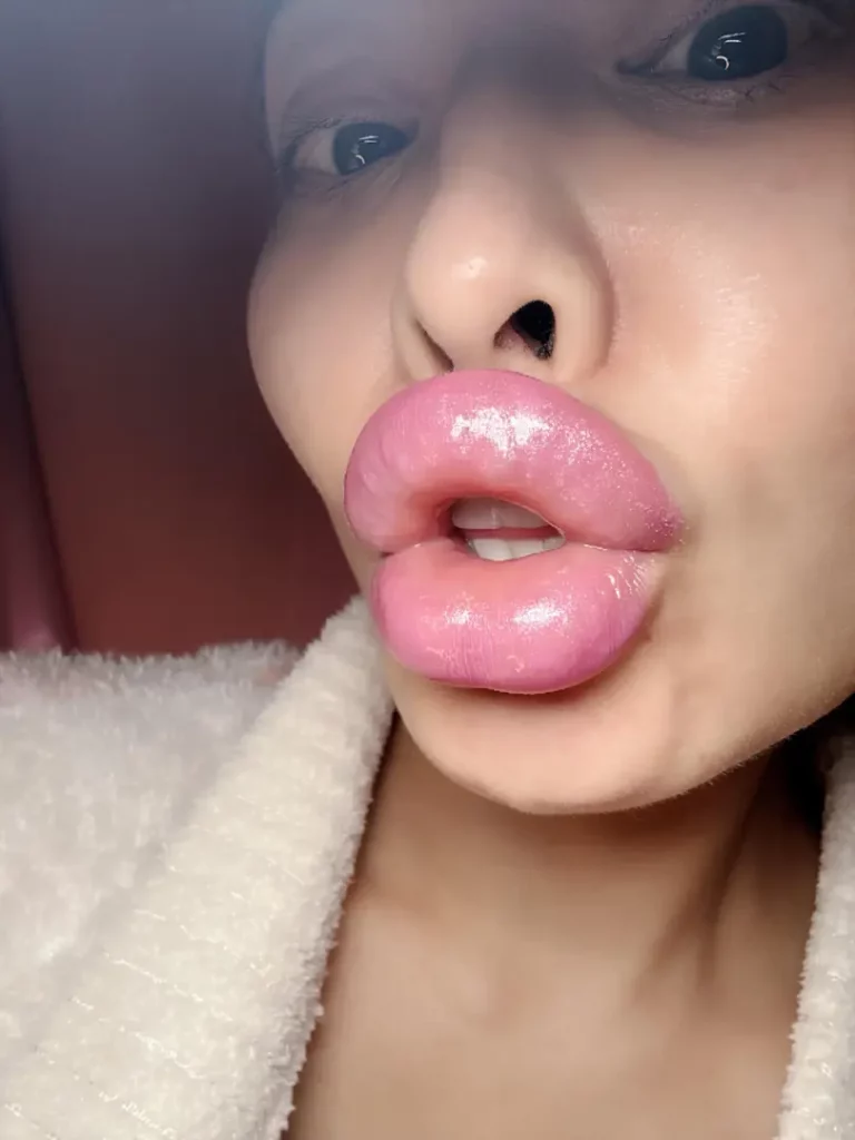 My Lips Are Still Pumped And So Fucking Sexy After My Warm Bath