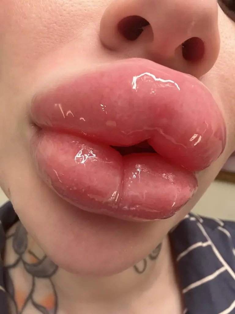 My Puffy DSLs: Europe's Mesmerizing, Mouth-Watering Perfection