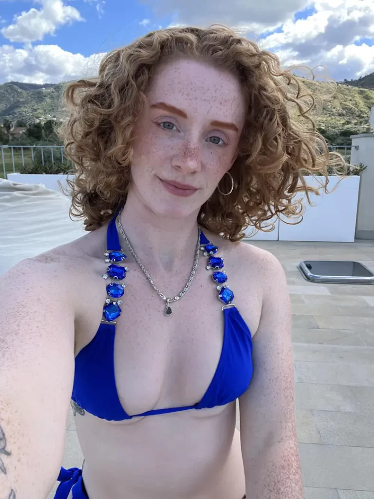 Pure Ginger Fire: My Freckled Nose Is Absolutely Irresistible
